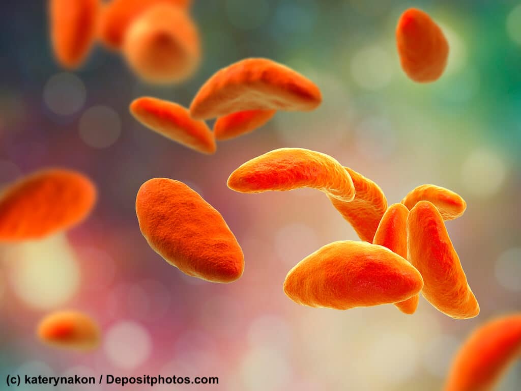 Der intrazelluläre Parasit Toxoplasma gondii